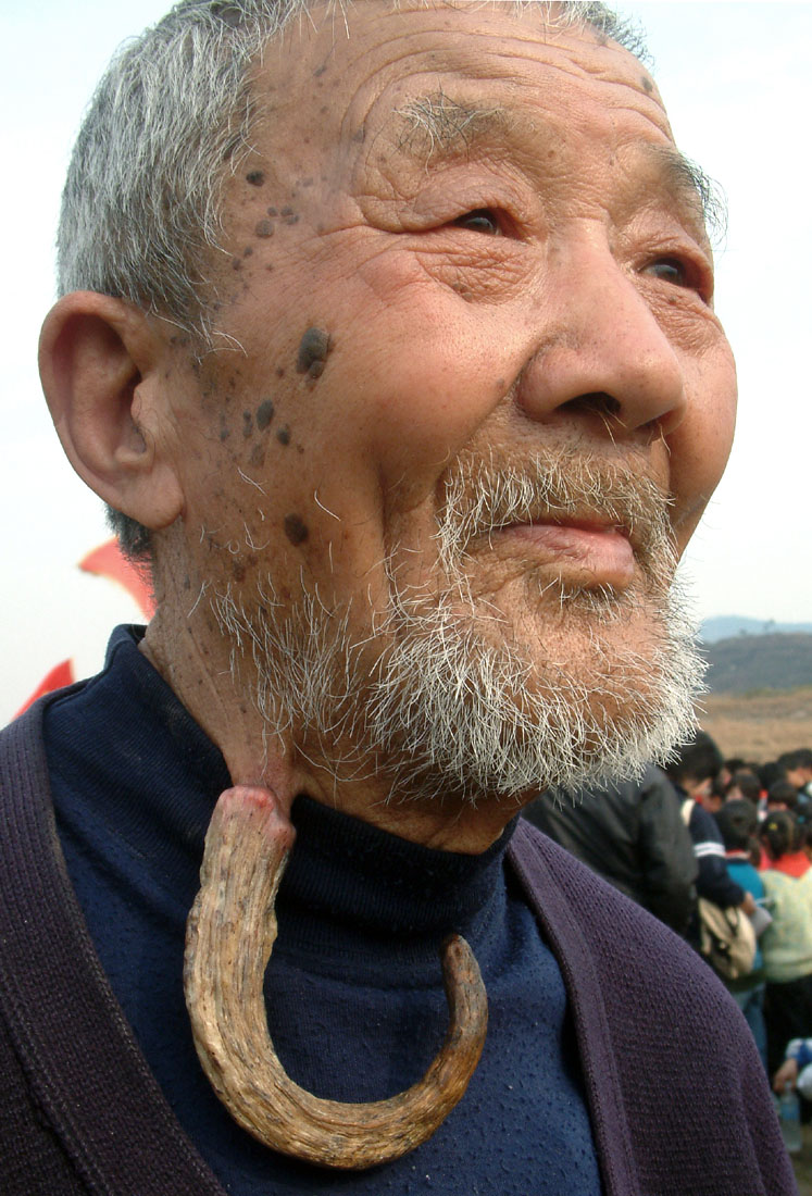 84岁的王同照老人头颈长角